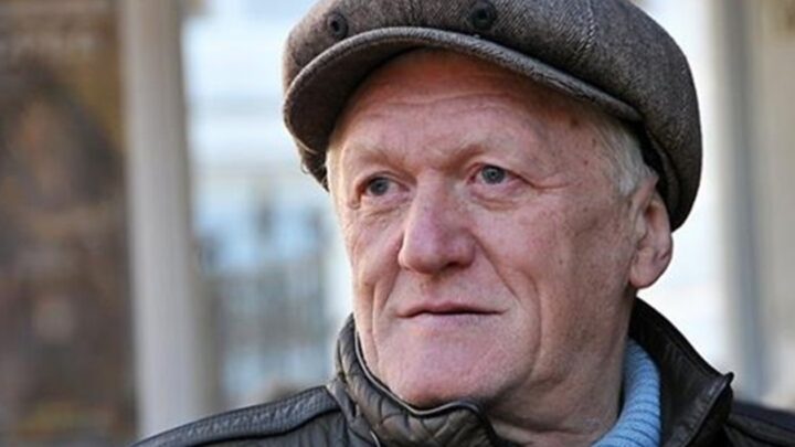 Відомий продюсер розповів про невдалі косметологічні процедури