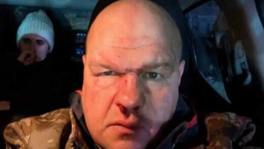 Скандал на Тернопільщині: мажори після ДТП побили військового та намагалися зам’яти справу через ТЦК